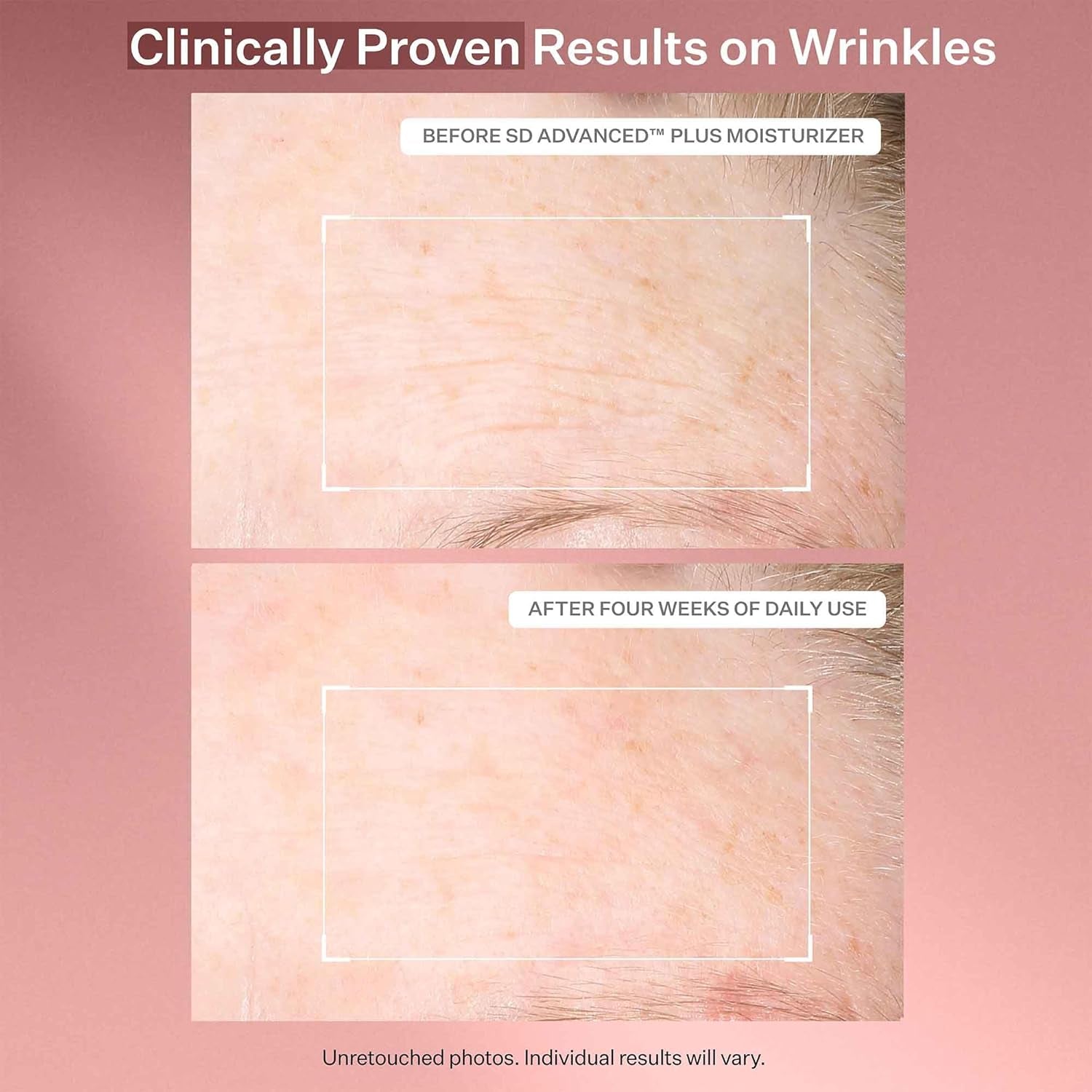 Strivectin anti Wrinkle Trio Kit for Face & Eyes, 3 Piece Kit with SD plus Moisturizer, Peptide Plump Line Face Serum, & Intensive Eye Concentrate Wrinkle Cream, Anti-Aging for Wrinkles and Fine Lines
